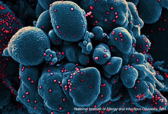 SARS-CoV-2 and cells